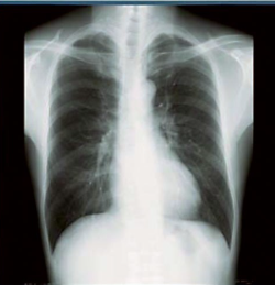 FILM DE RADIOGRAPHIE – Image 4