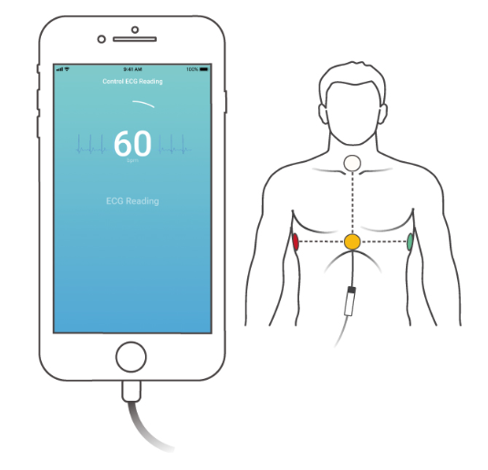 ECG CARDIOSECUR – Image 5