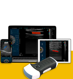 ECHOGRAPHE DOPPLER COULEUR CTX100