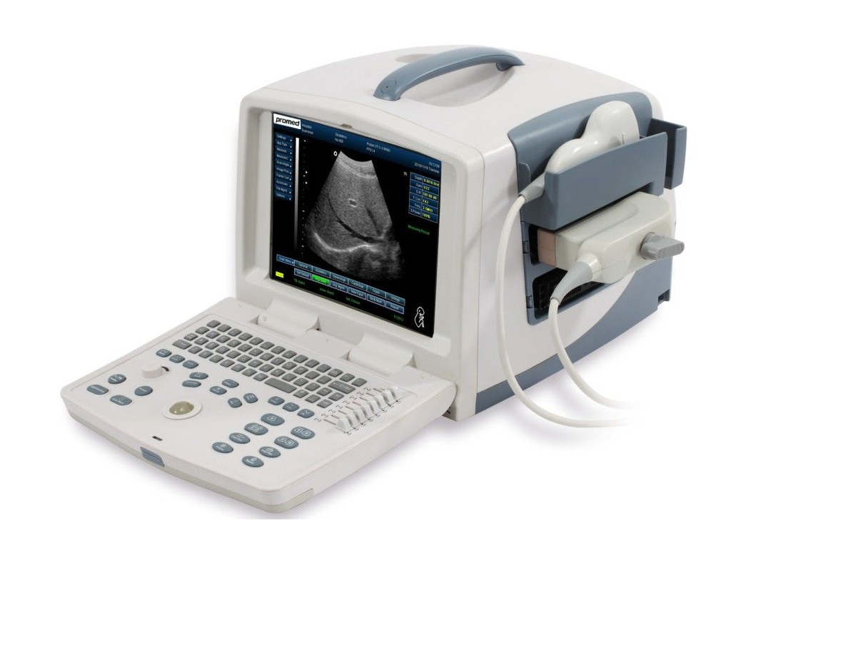 ECHOGRAPHE PORTATIF ULTRASOUND – Image 3