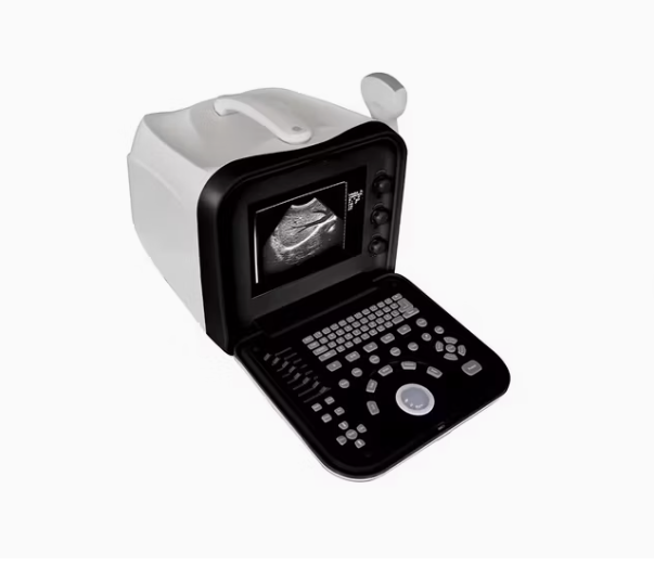 ECHOGRAPHE PORTATIF ULTRASOUND – Image 5