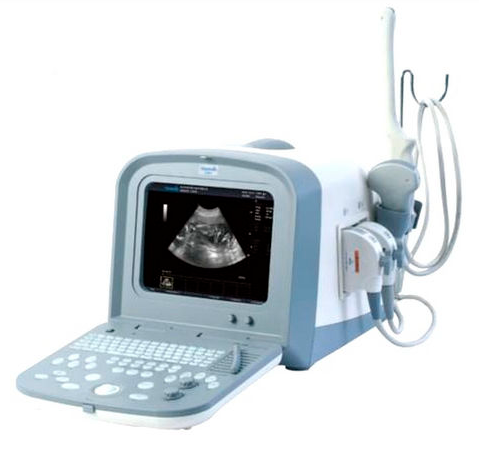 ECHOGRAPHE PORTATIF ULTRASOUND – Image 8