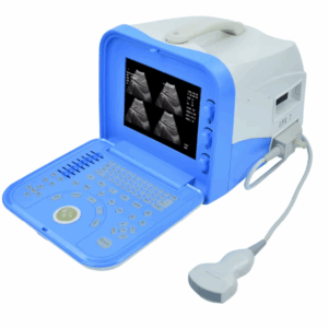 ECHOGRAPHE PORTATIF ULTRASOUND