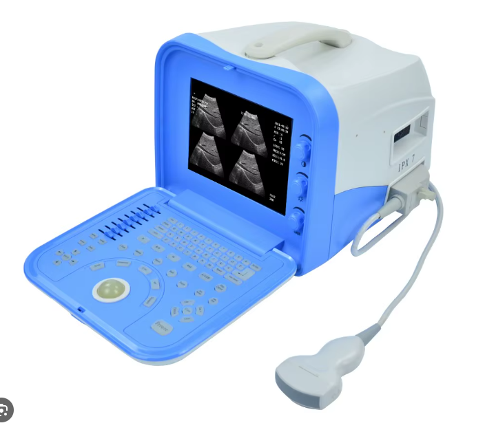ECHOGRAPHE PORTATIF ULTRASOUND