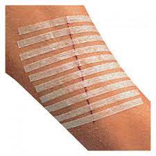 SPARADRAP DE SUTURE- SUTURES CUTANÉES STRIPS