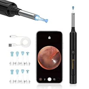 OTOSCOPE OREILLE AVEC CAMERA - NETTOYEUR D'OREILLE