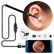 OTOSCOPE CAMERA POUR OREILLE