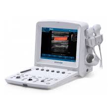 ECHOGRAPHE PORTABLE DOPPLER COULEUR EDAN U50