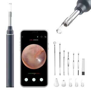 OTOSCOPE CAMERA LED LUMIERE POUR IPHONE ET ANDROID