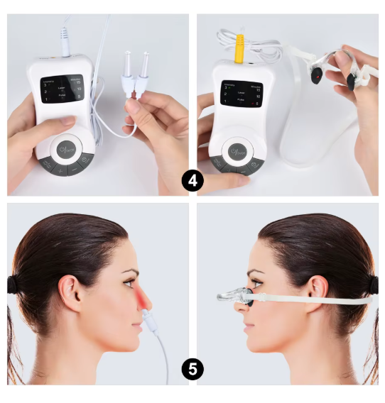 DISPOSITIF DE TRAITEMENT NASAL (RHINITE, CONGESTION...) – Image 4