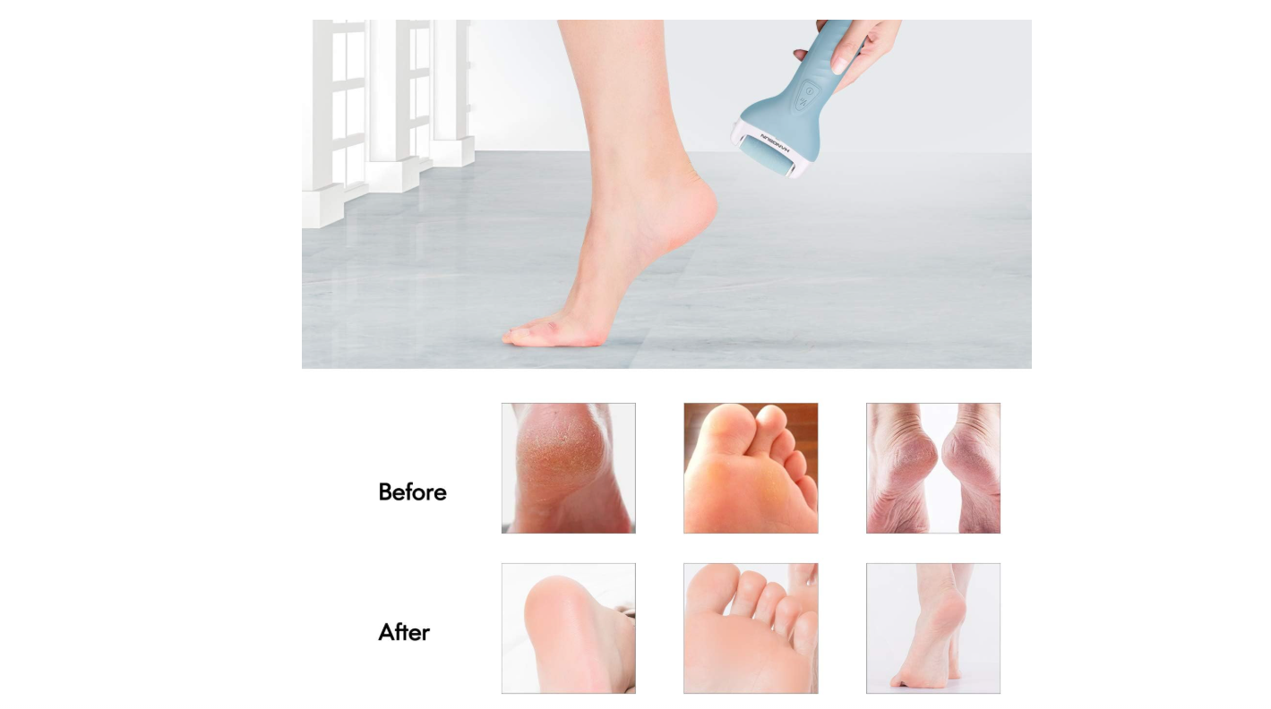 RAPE A PIEDS – Image 5