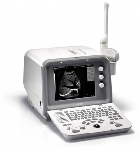 ECHOGRAPHE EDAN DUS 3 – Image 2