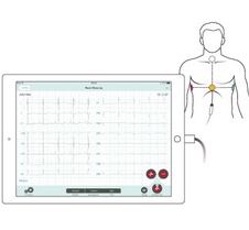 ECG CARDIOSECUR – Image 4