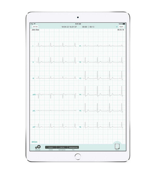 ECG CARDIOSECUR – Image 3