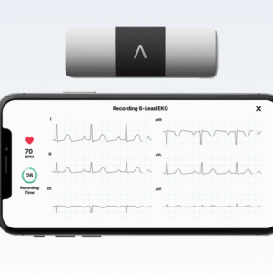 ECG PORTABLE KARDIAMOBILE 6L